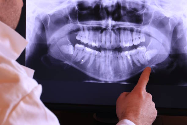 Best Emergency Dental Care for Broken or Chipped Teeth in Window Rock, AZ